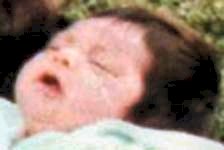 Photo of Alexander Ferguson
